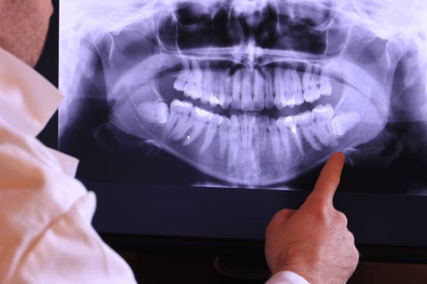 Best Emergency Dental Care for Sports Injuries in Moose Lake, MN