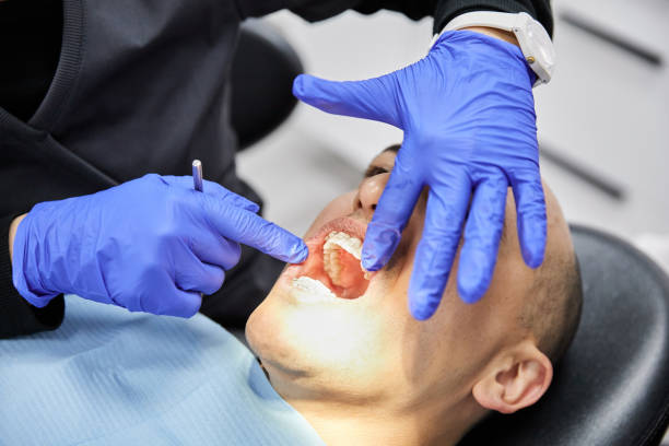 Best Knocked-Out Tooth (Avulsed Tooth) Treatment in Moose Lake, MN
